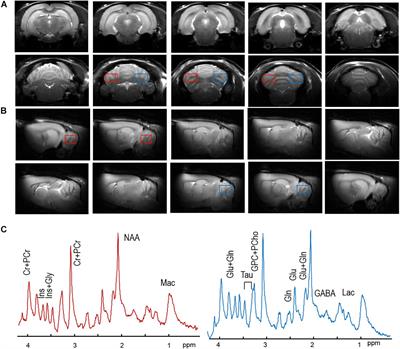 Mild Neonatal Brain Hypoxia-Ischemia in Very Immature Rats Causes Long-Term Behavioral and Cerebellar Abnormalities at Adulthood